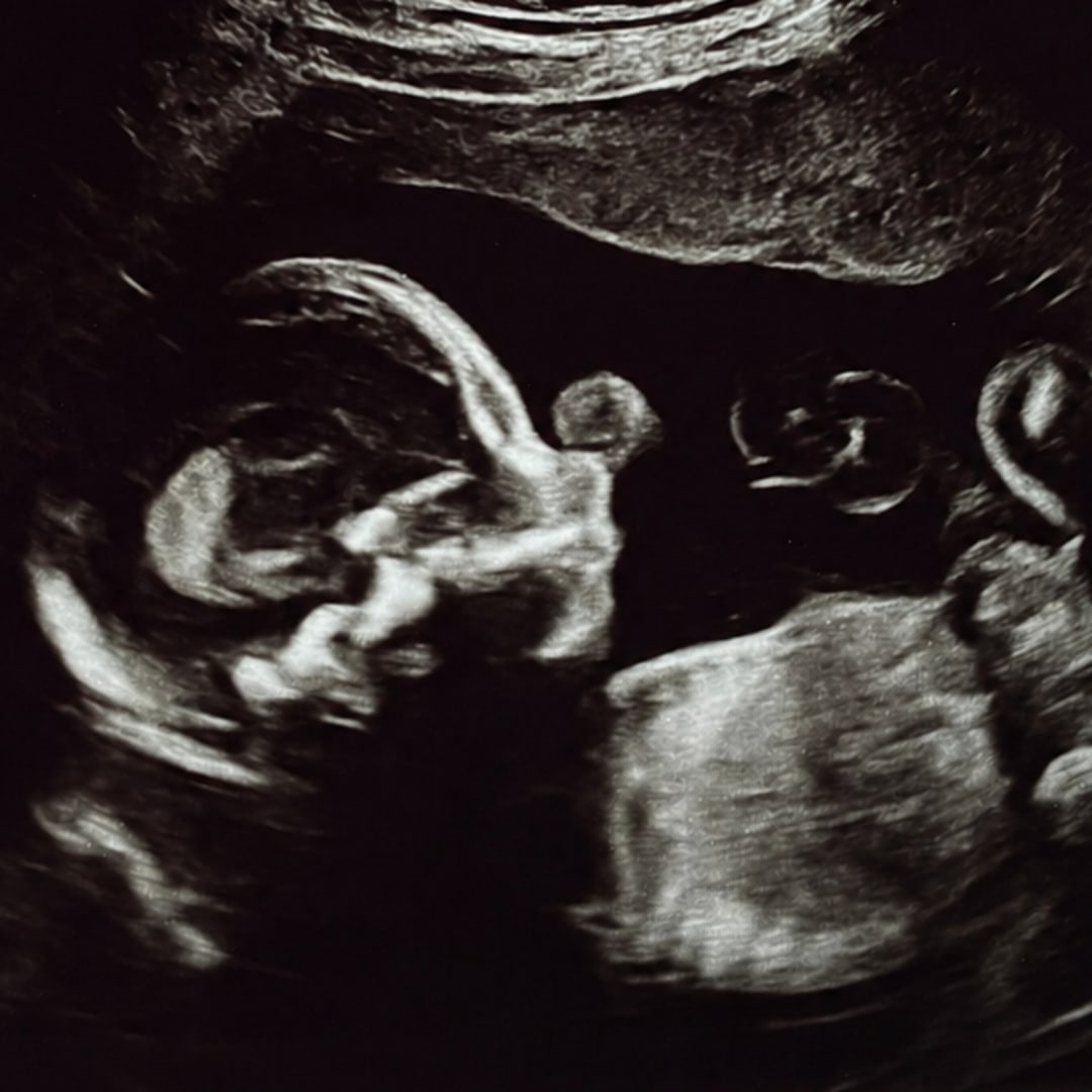 Photo shared by Helen for their Babylist baby registry.