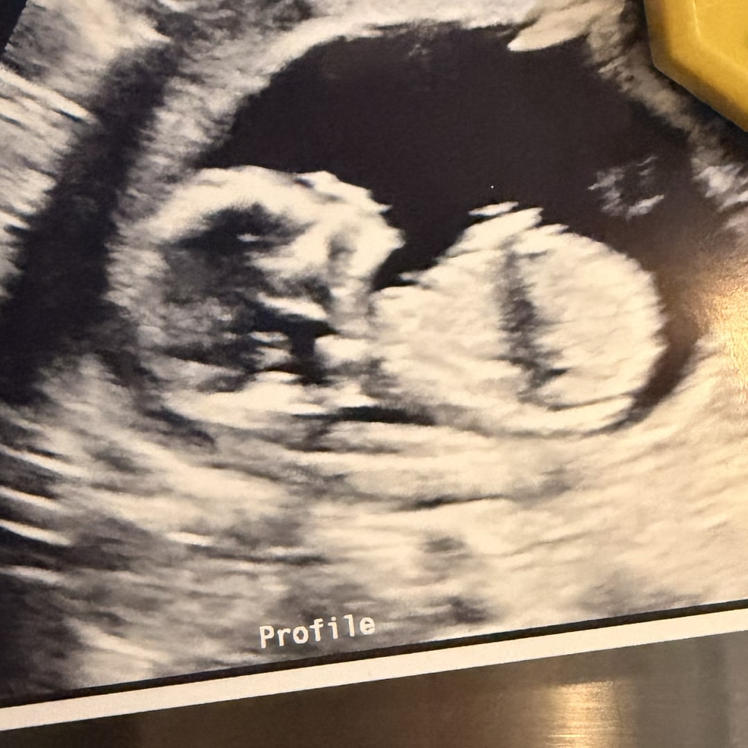 Photo shared by Jacqueline for their Babylist baby registry.