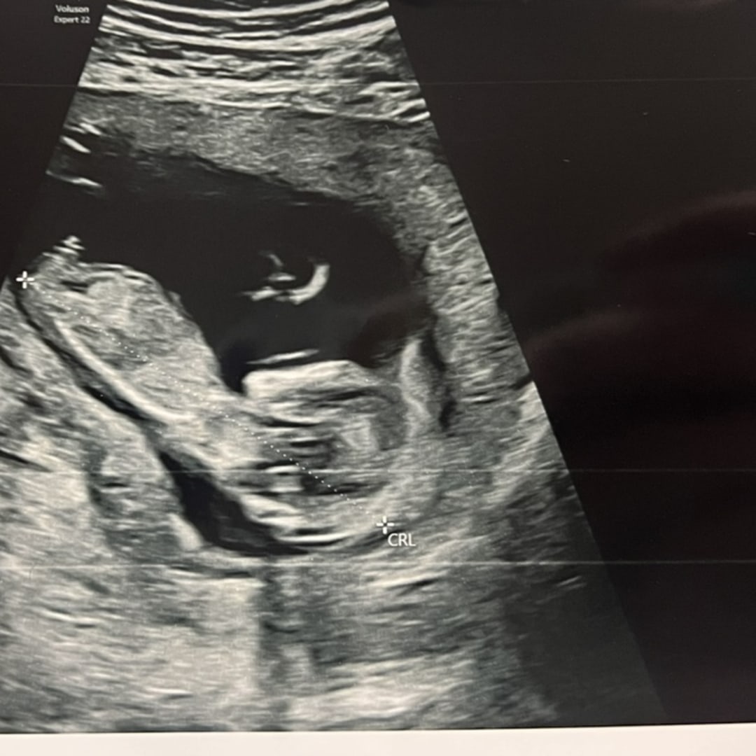 Photo shared by Amanda for their Babylist baby registry.