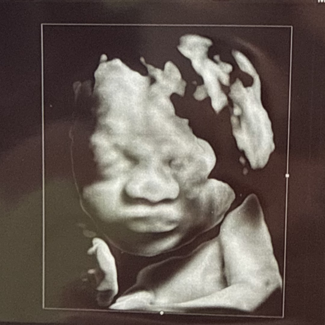 Photo shared by Ellie for their Babylist baby registry.