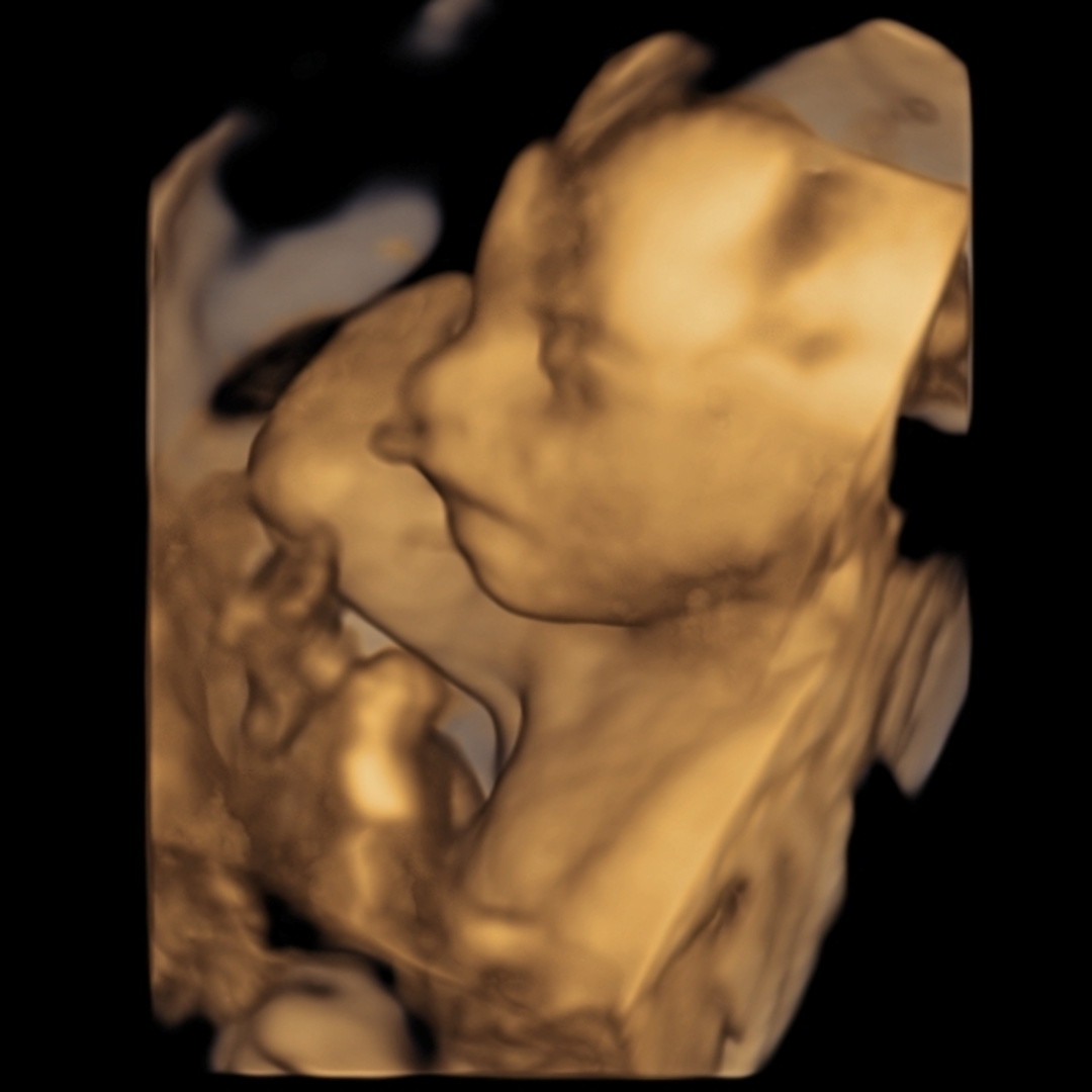 Photo shared by Daryan for their Babylist baby registry.