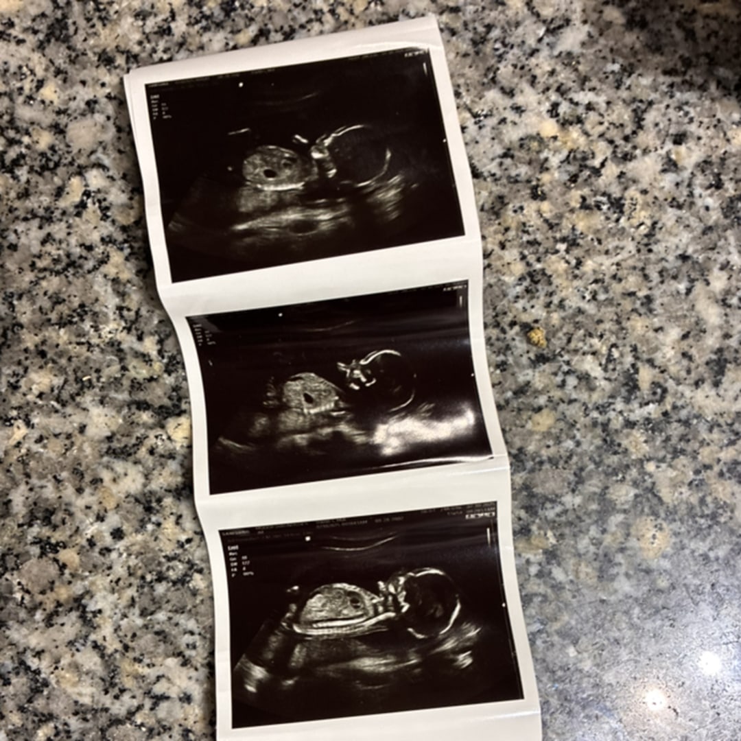 Photo shared by Mia for their Babylist baby registry.