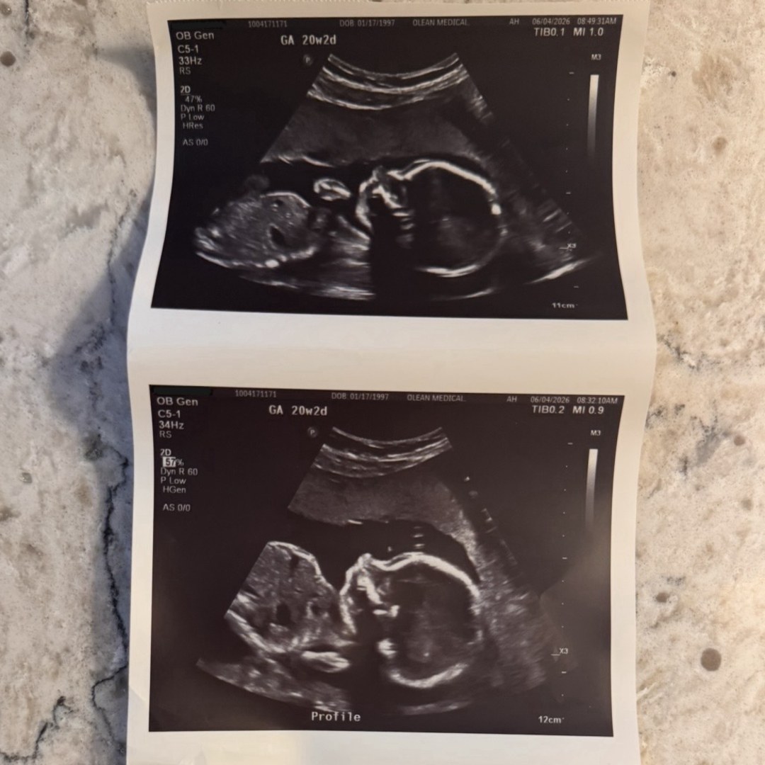Photo shared by Sara for their Babylist baby registry.