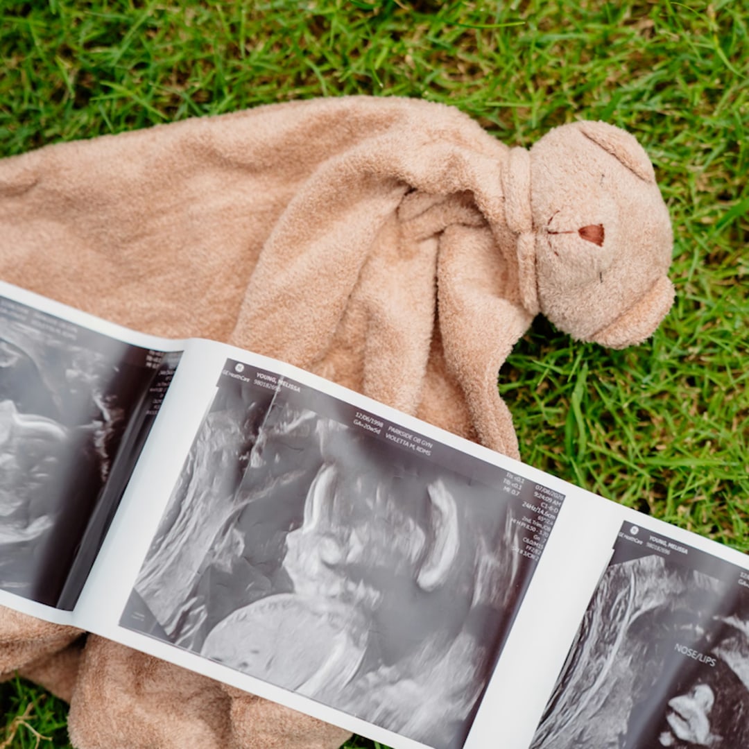 Photo shared by Melissa for their Babylist baby registry.