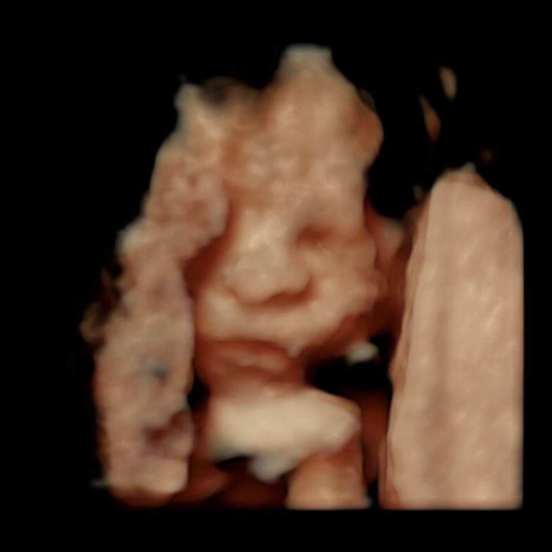 Photo shared by Haley for their Babylist baby registry.