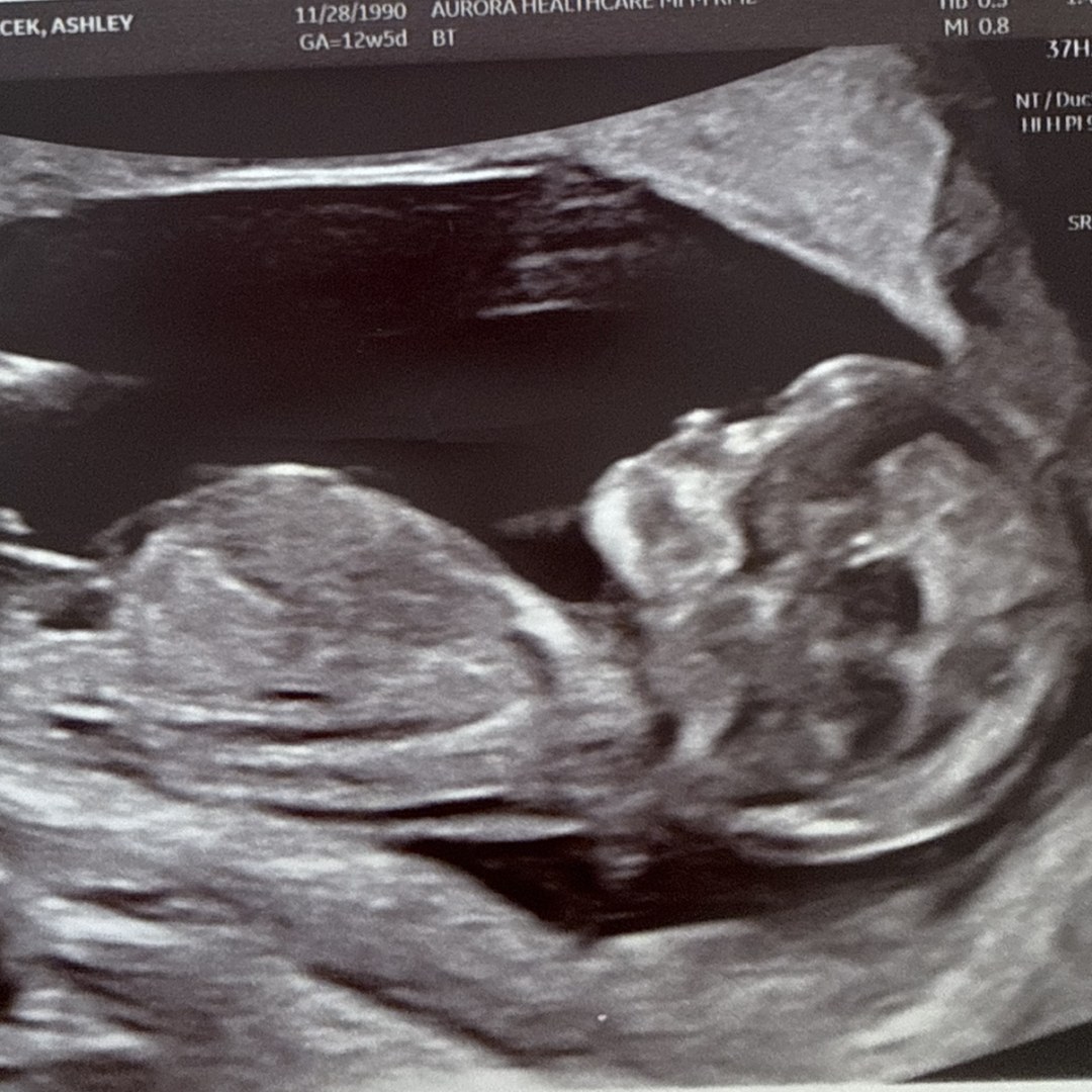 Photo shared by Ashley for their Babylist baby registry.