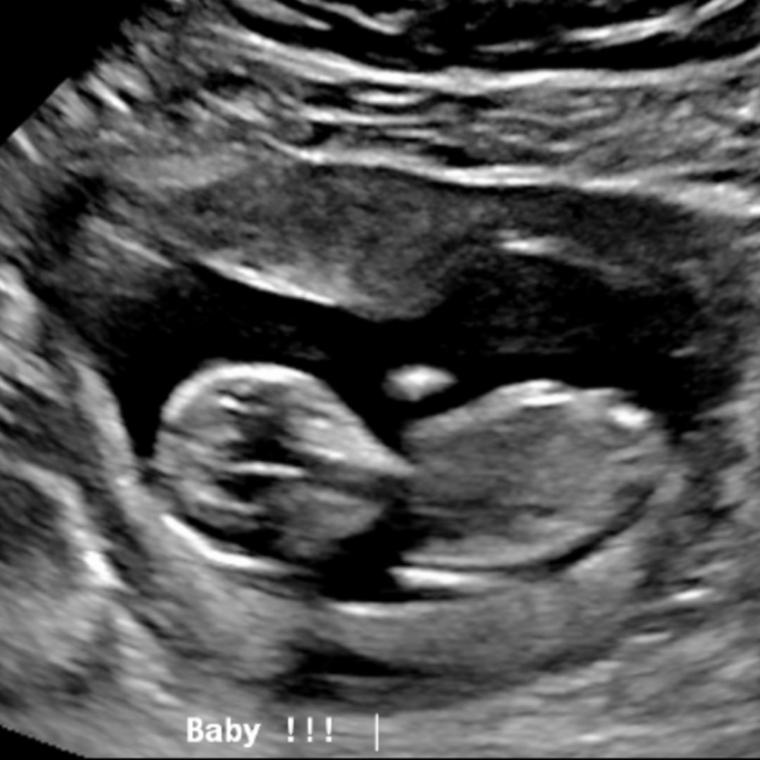 Photo shared by Heather for their Babylist baby registry.