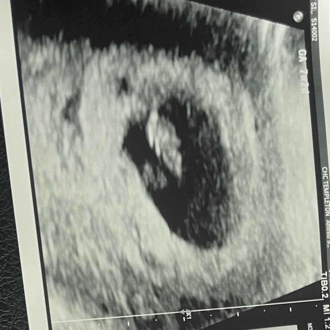 Photo shared by Amethyst for their Babylist baby registry.