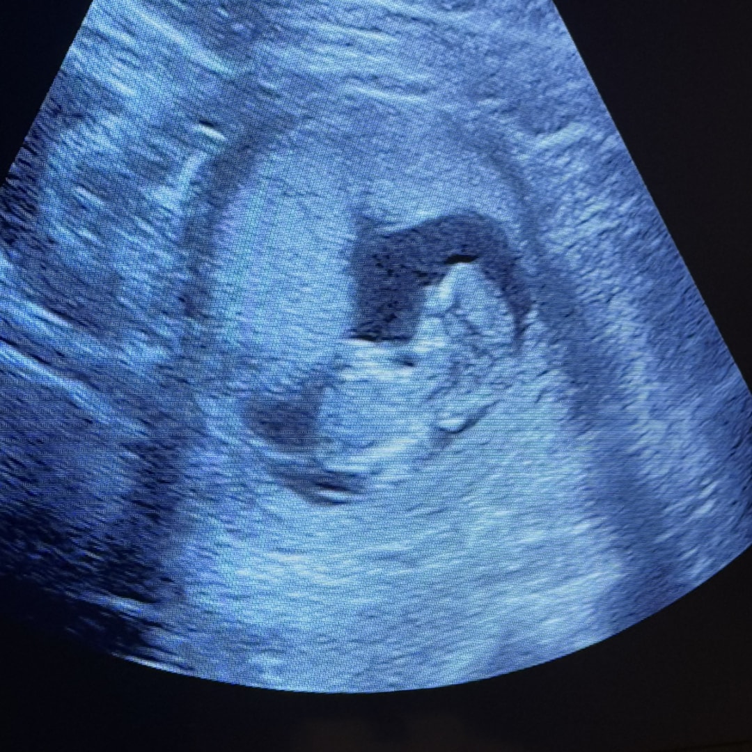 Photo shared by Emily for their Babylist baby registry.