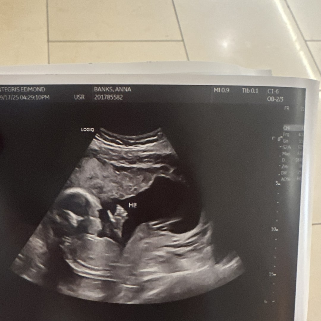 Photo shared by Anna for their Babylist baby registry.