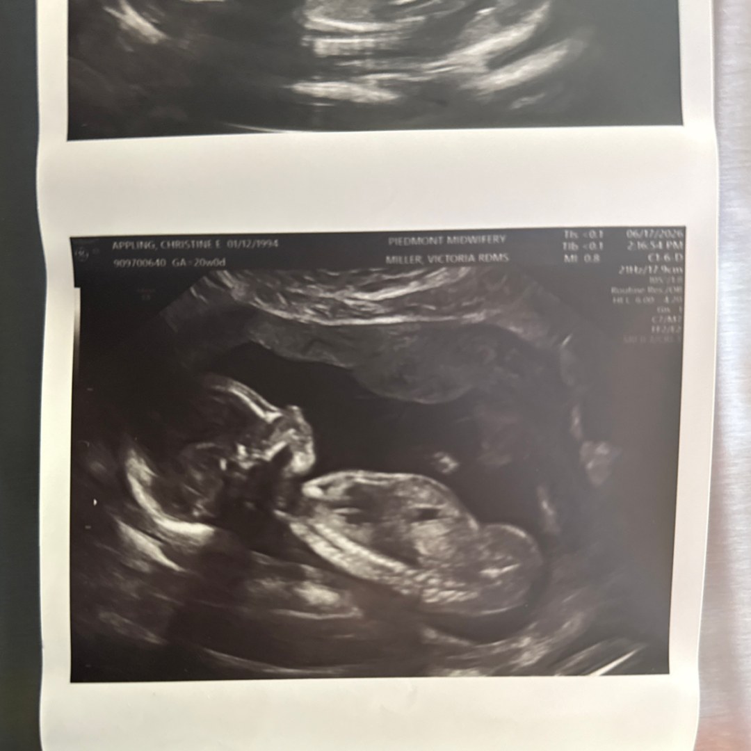 Photo shared by Christine for their Babylist baby registry.
