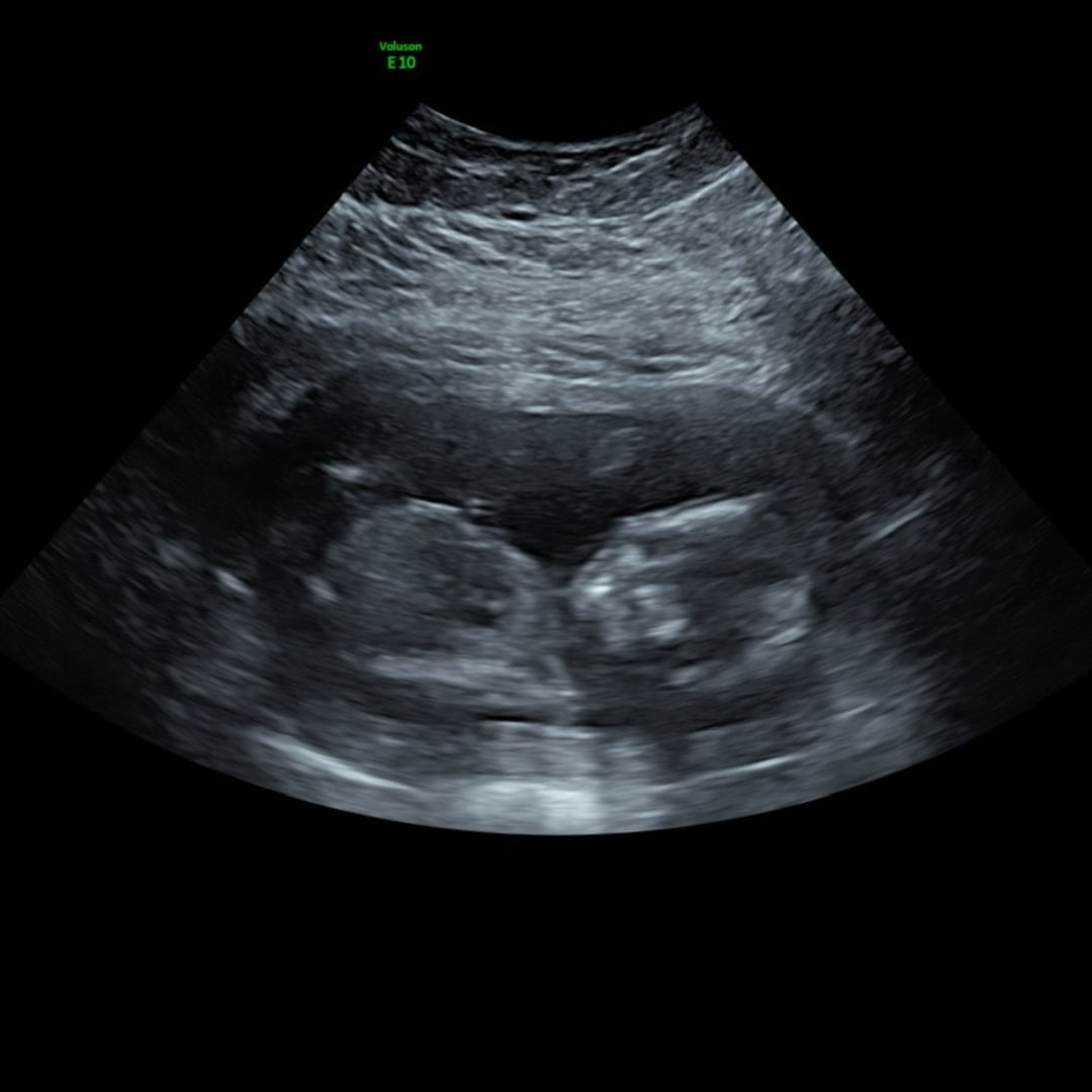 Photo shared by Hannah for their Babylist baby registry.