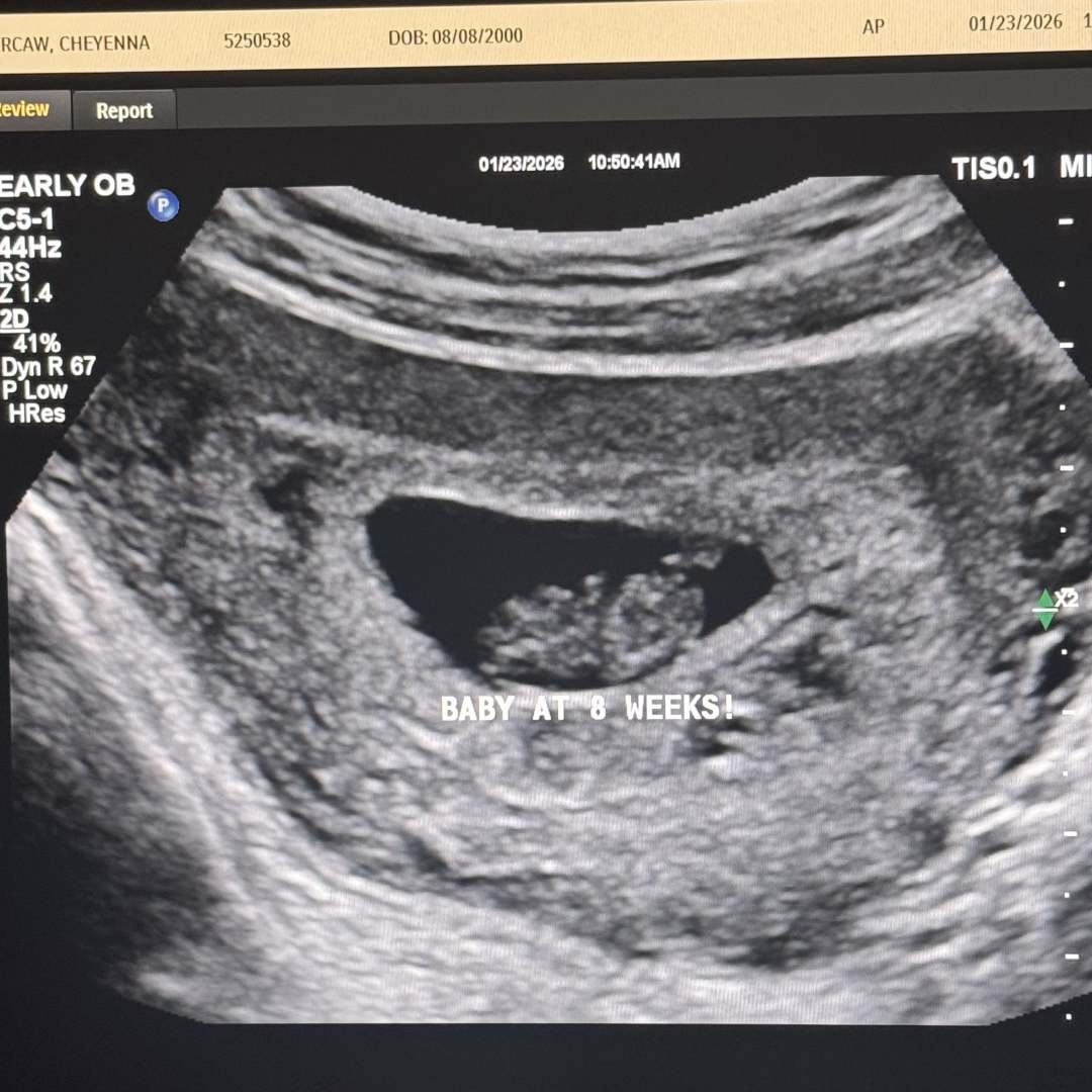 Photo shared by Cheyenne for their Babylist baby registry.