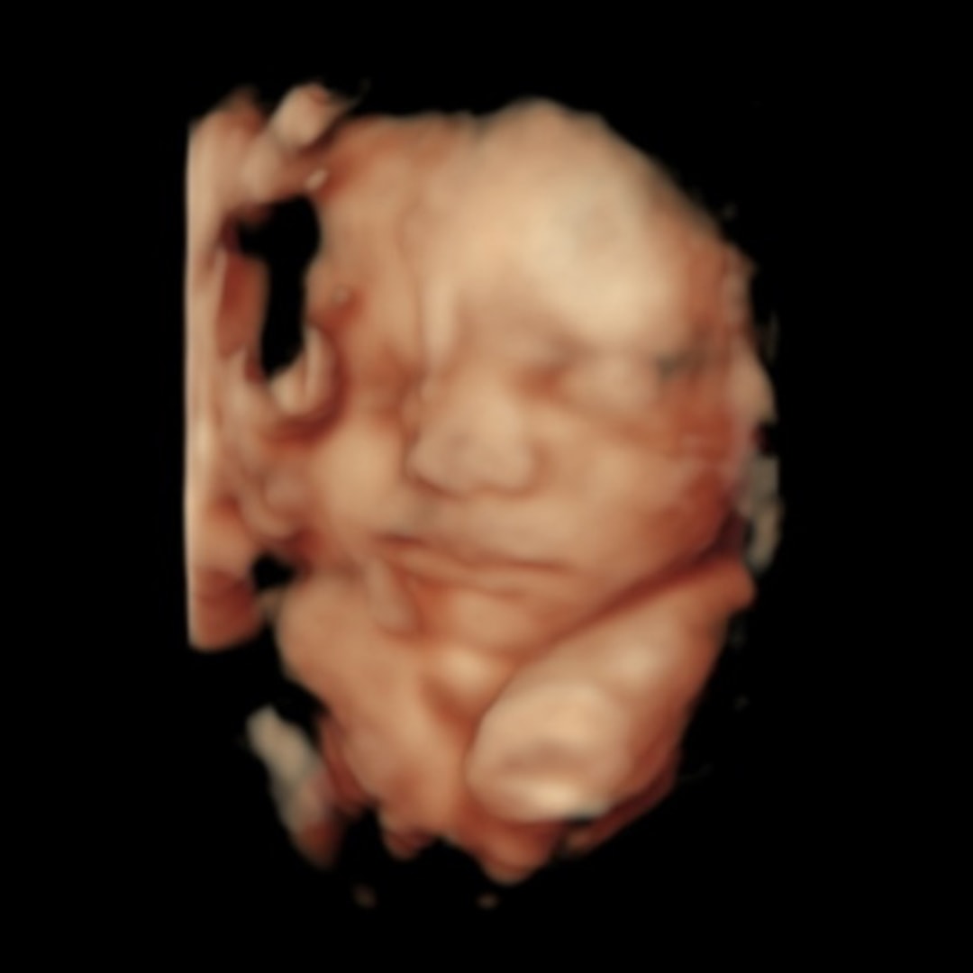Photo shared by Gracie for their Babylist baby registry.