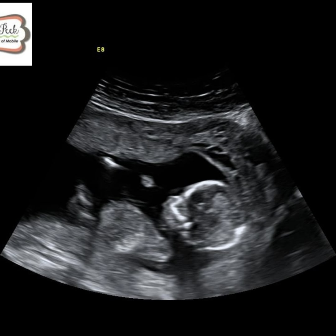 Photo shared by Courtney for their Babylist baby registry.