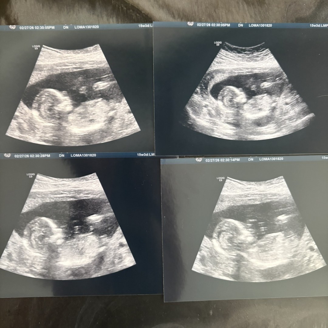 Photo shared by Athena for their Babylist baby registry.