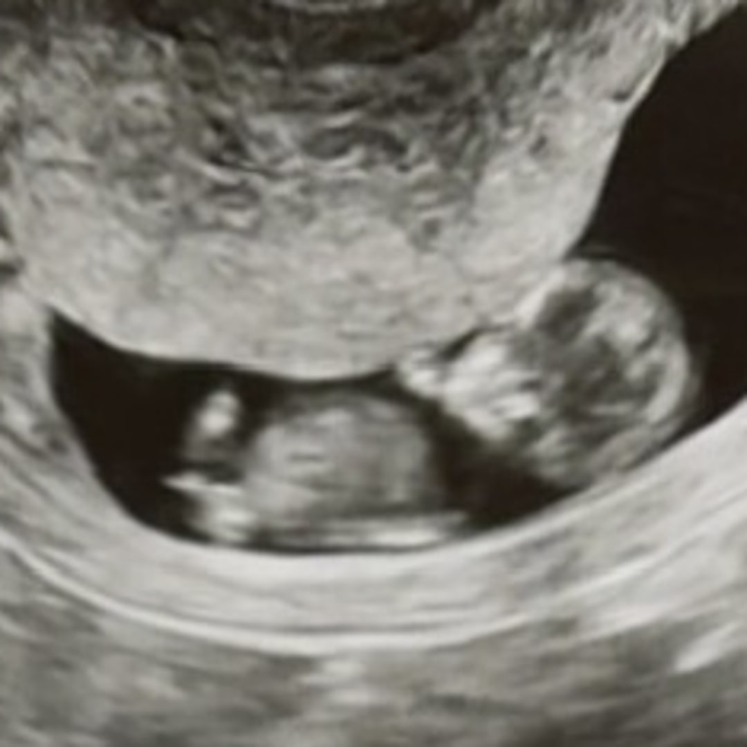 Photo shared by Madison for their Babylist baby registry.