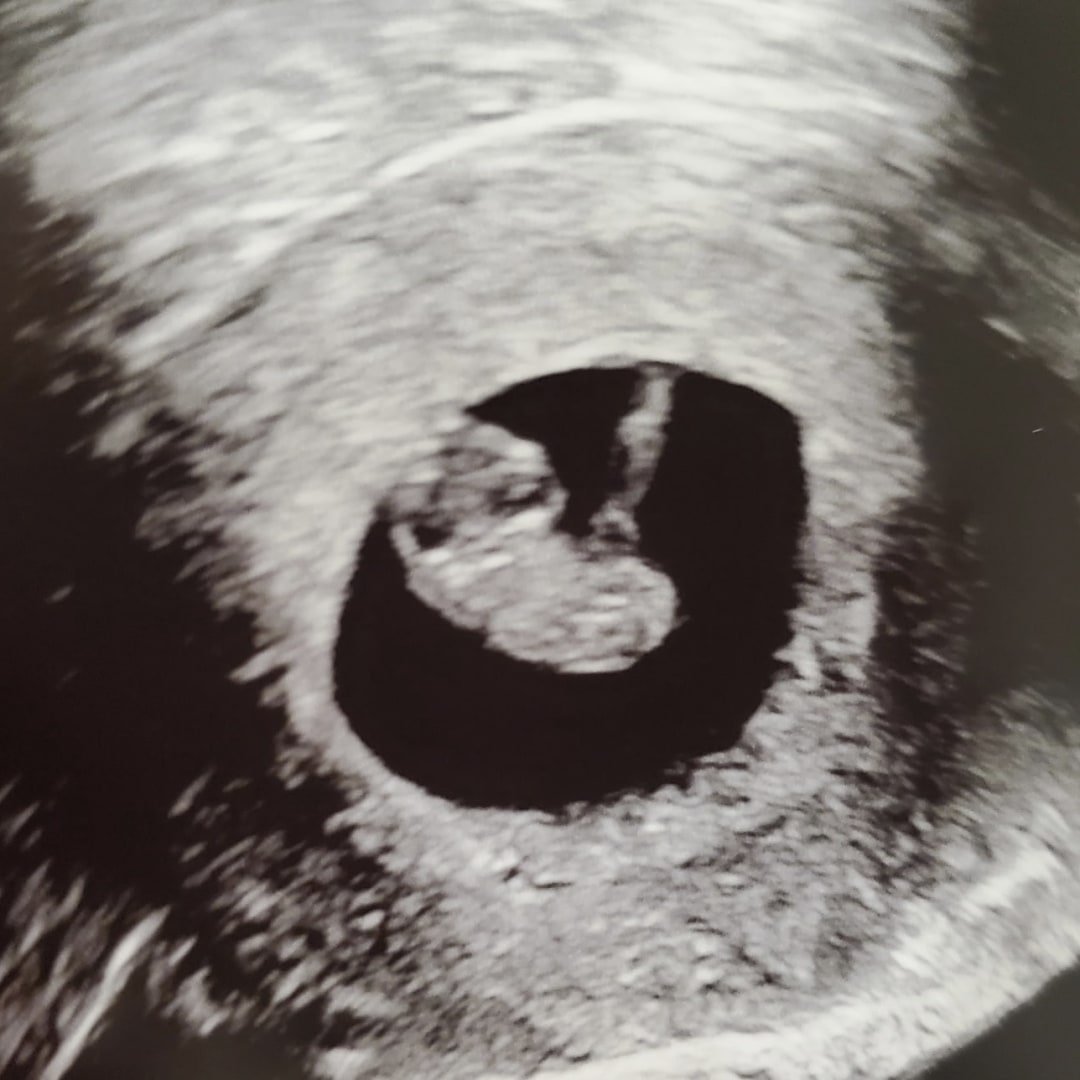 Photo shared by Taylor for their Babylist baby registry.