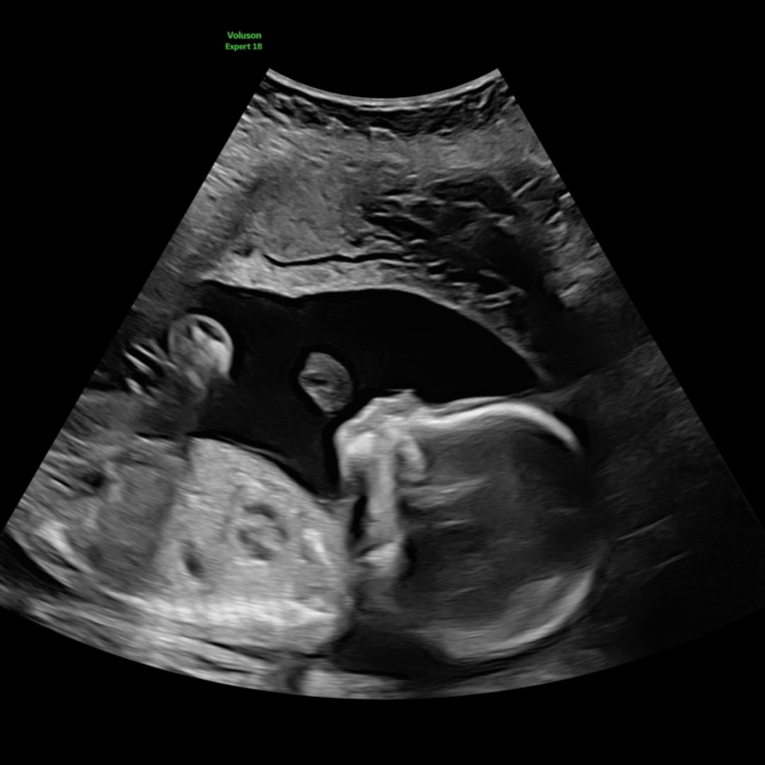 Photo shared by Makenzie for their Babylist baby registry.