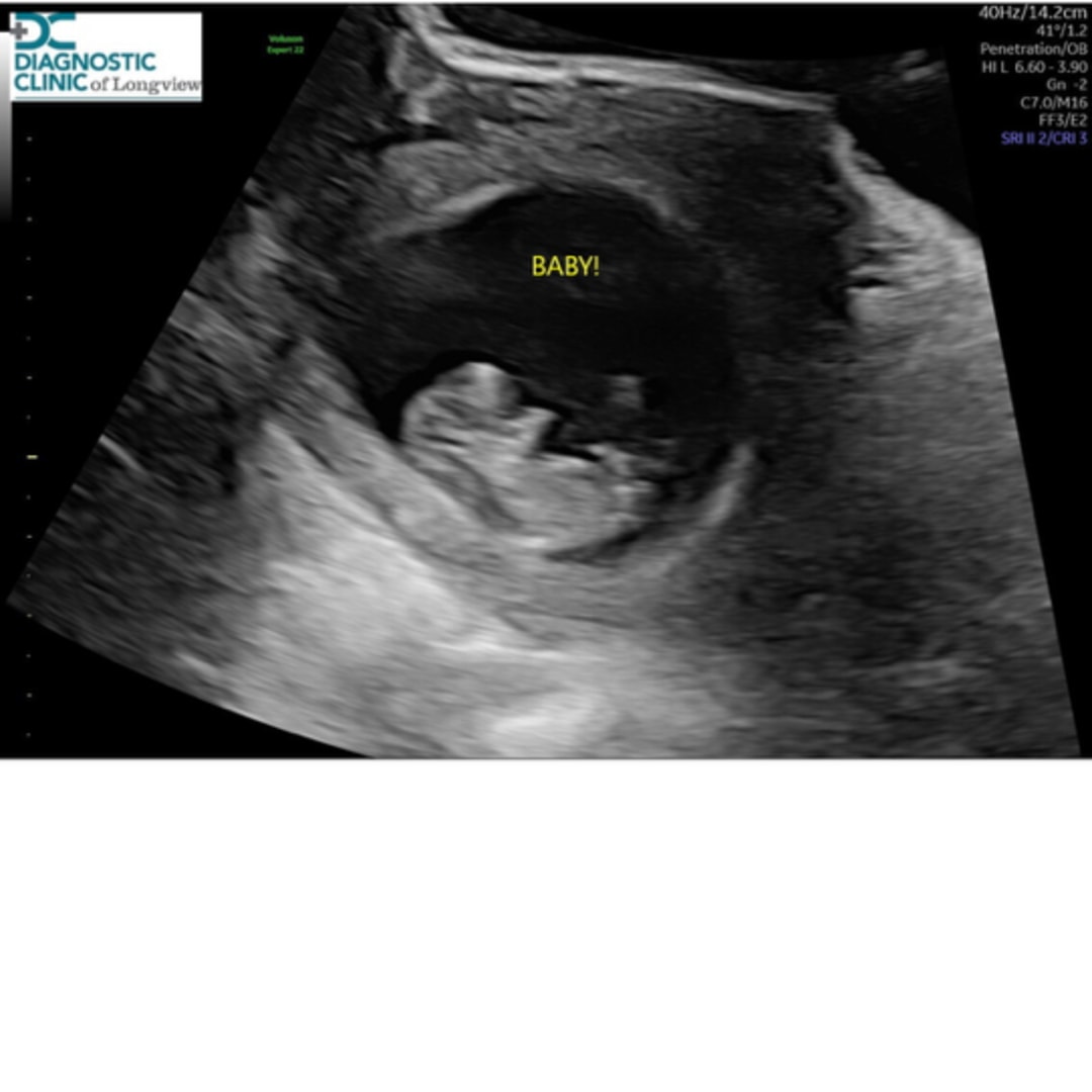 Photo shared by Amiracle for their Babylist baby registry.