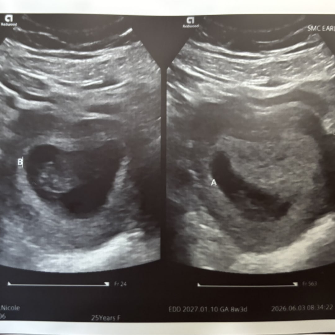 Photo shared by Alexis for their Babylist baby registry.