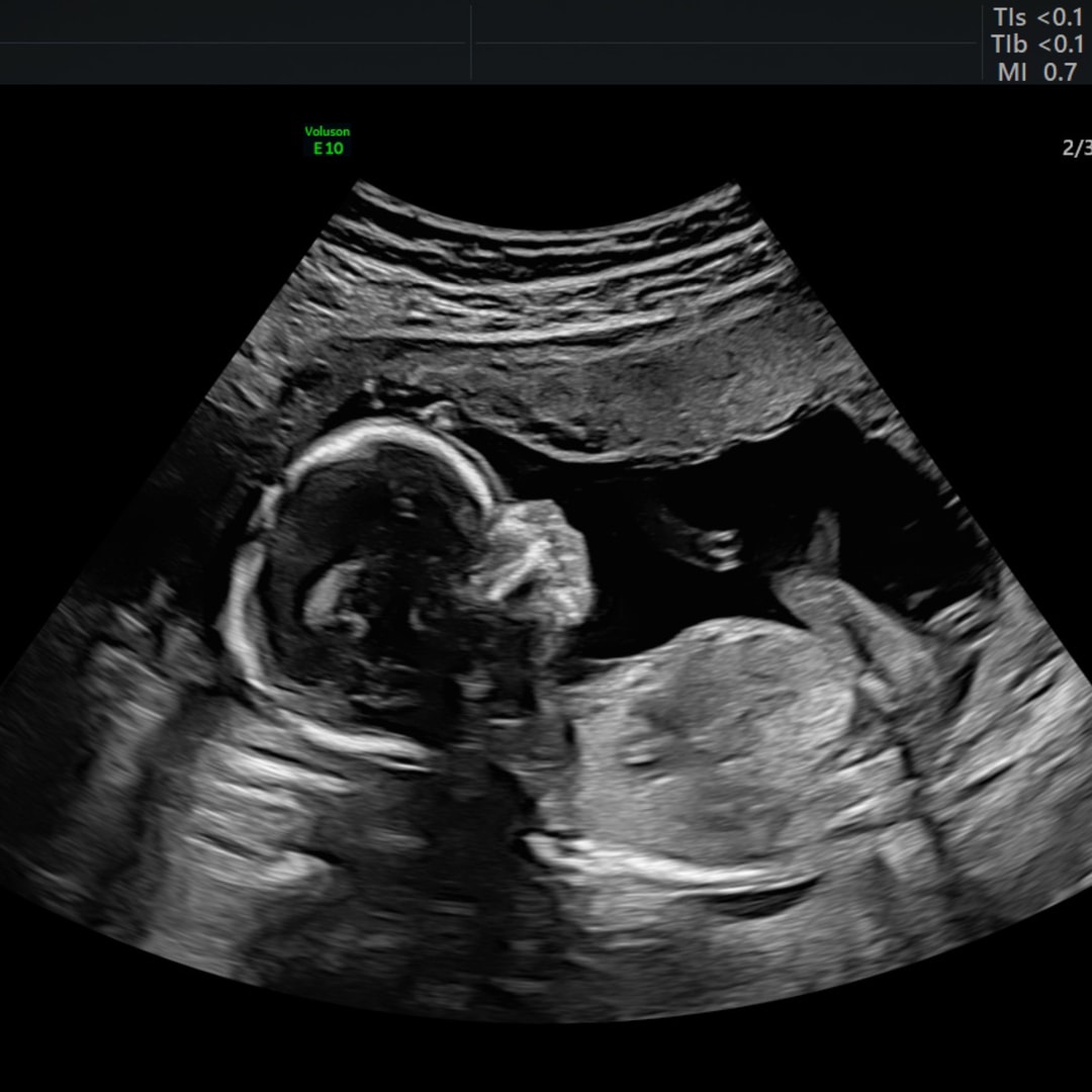 Photo shared by Faith for their Babylist baby registry.