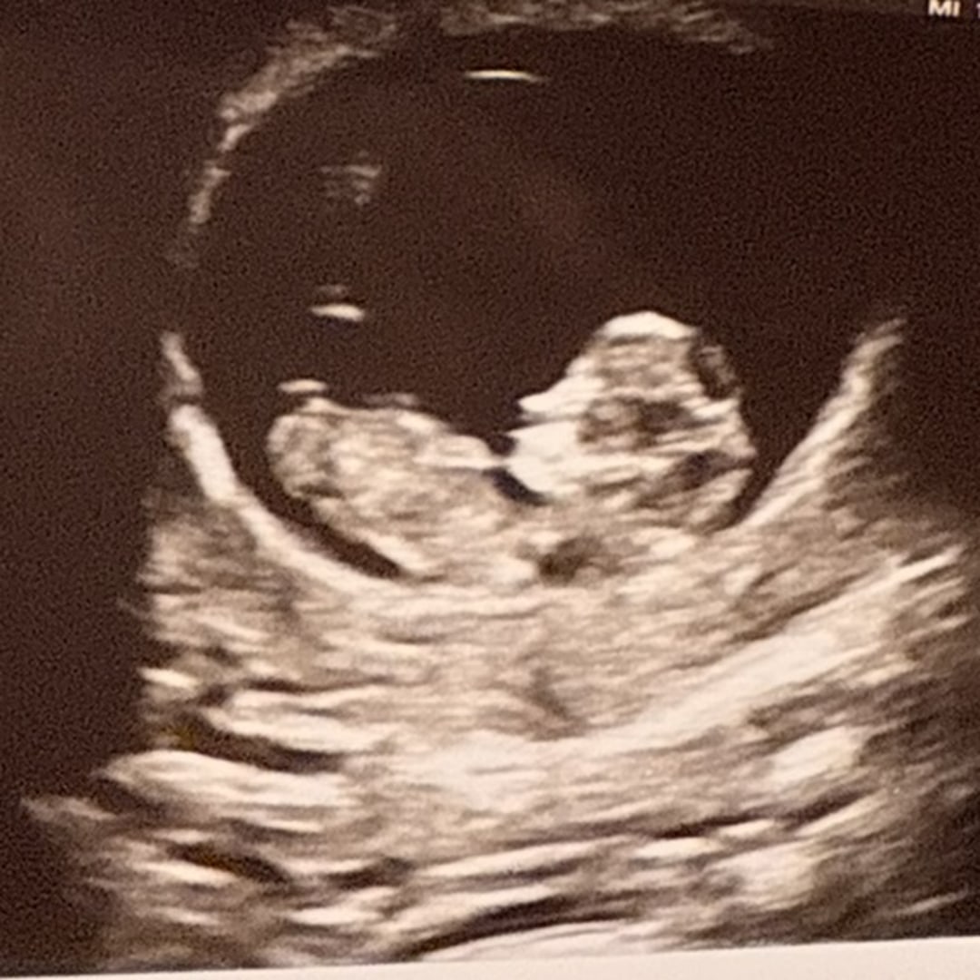Photo shared by Lauran for their Babylist baby registry.
