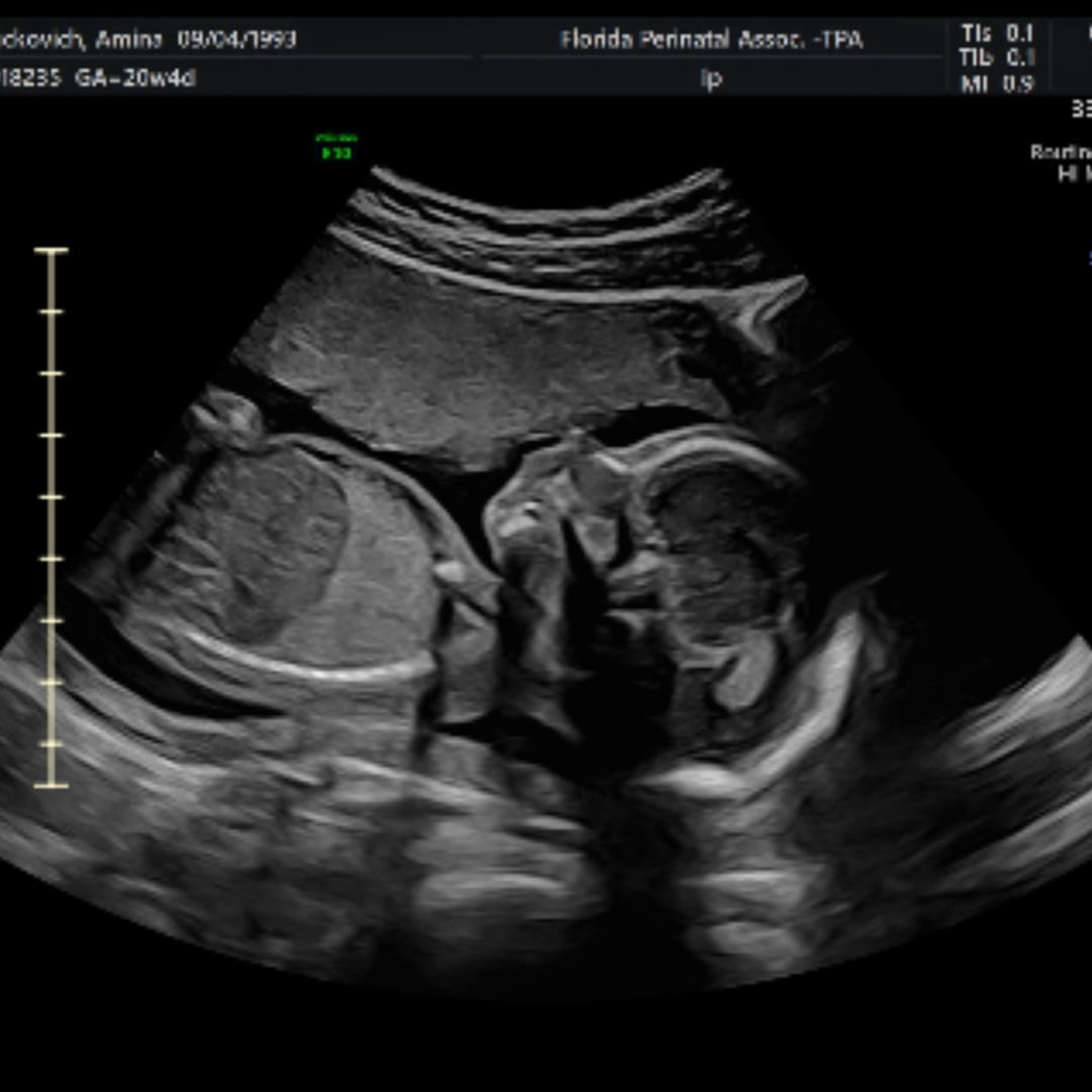 Photo shared by Amina for their Babylist baby registry.