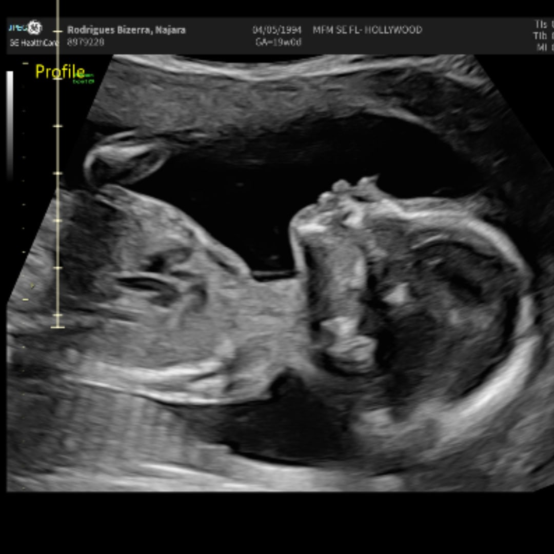 Photo shared by Najara for their Babylist baby registry.