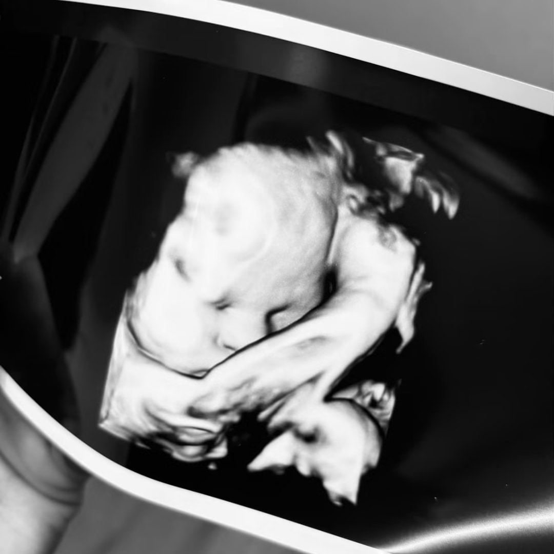 Photo shared by Ashley for their Babylist baby registry.