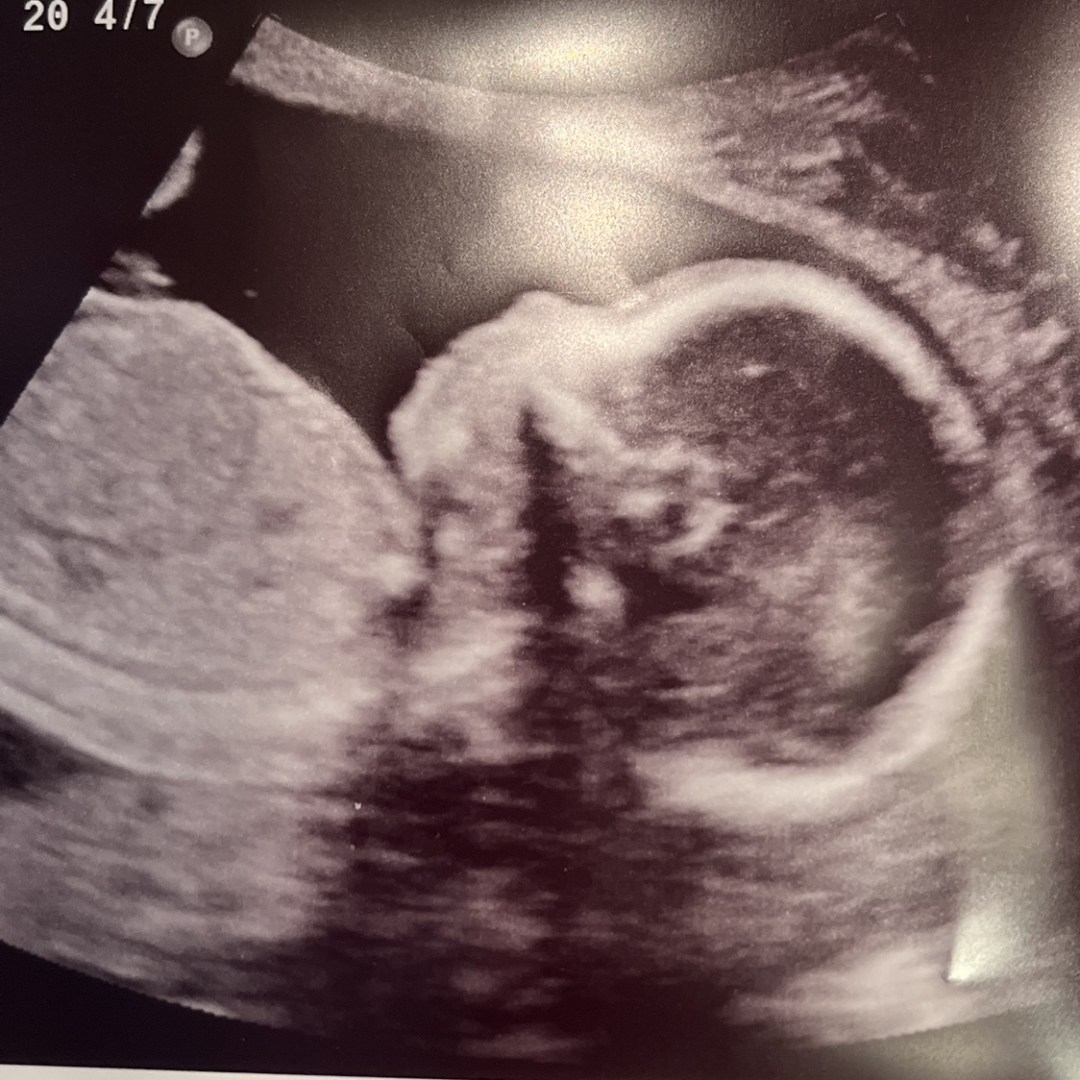 Photo shared by Leslie for their Babylist baby registry.