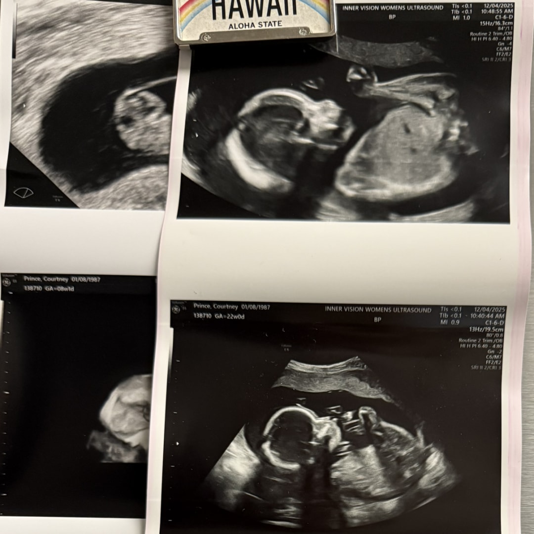 Photo shared by Courtney for their Babylist baby registry.