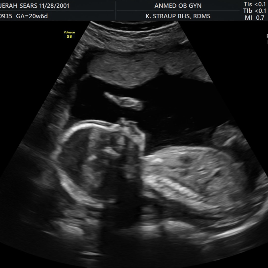 Photo shared by Jerah for their Babylist baby registry.