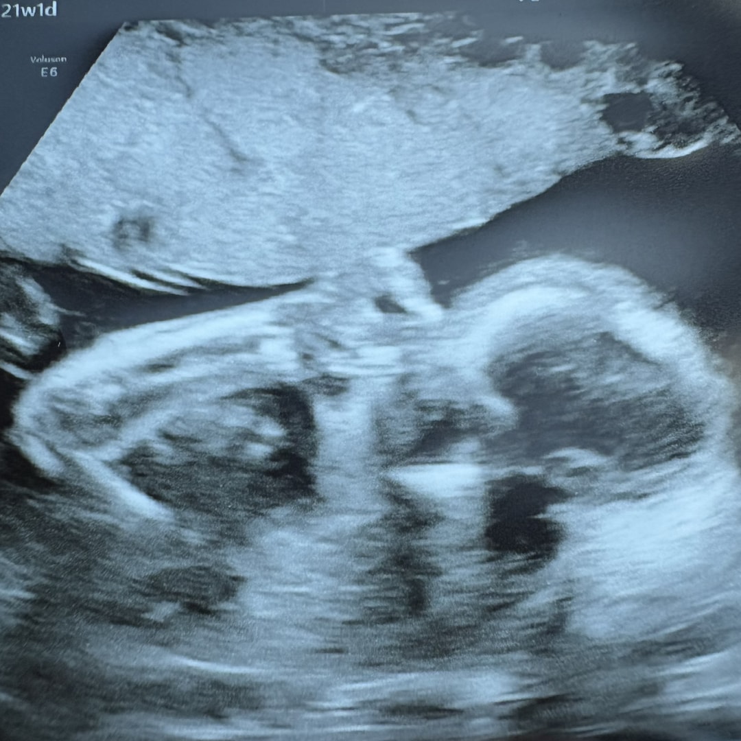 Photo shared by Corey for their Babylist baby registry.