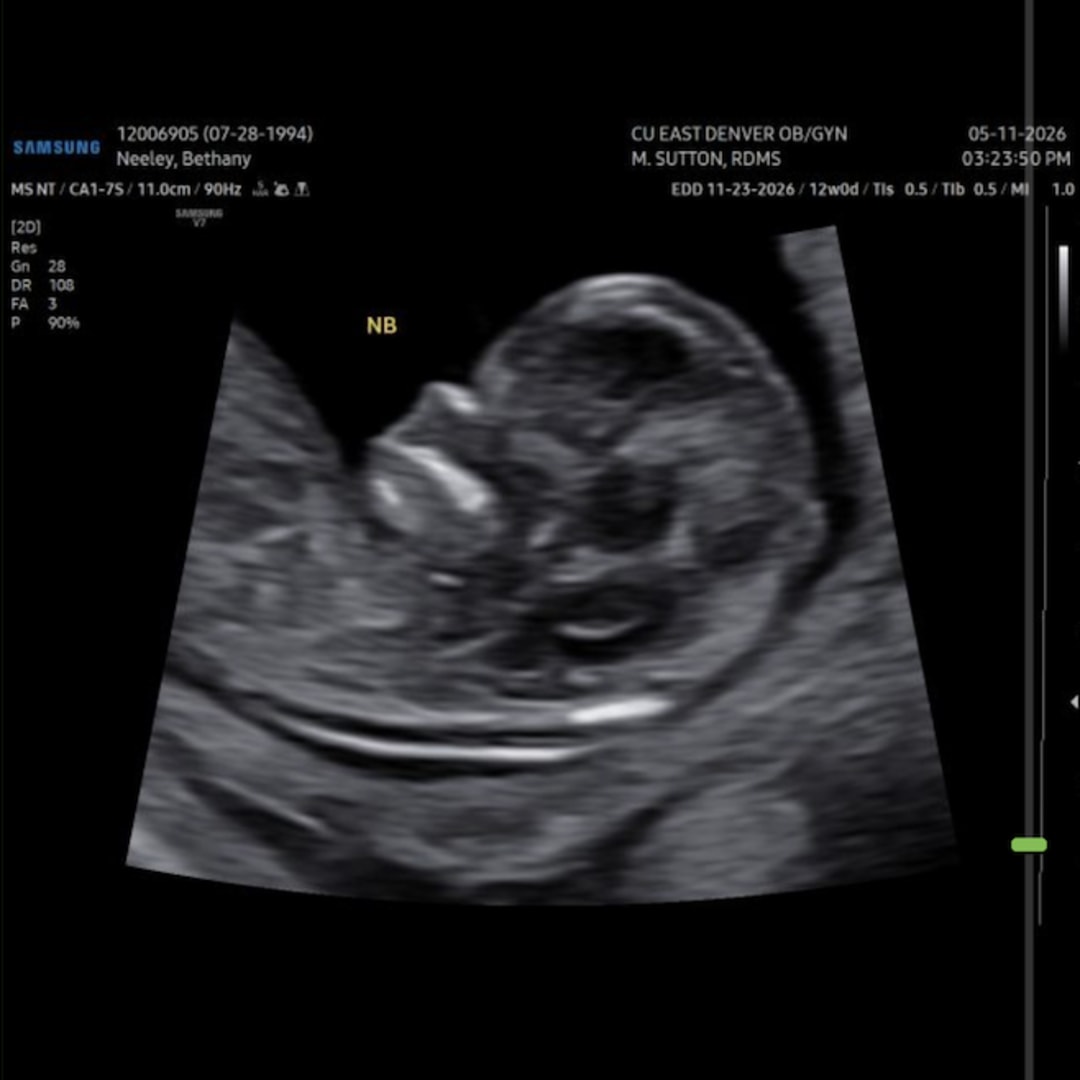 Photo shared by Bethany for their Babylist baby registry.