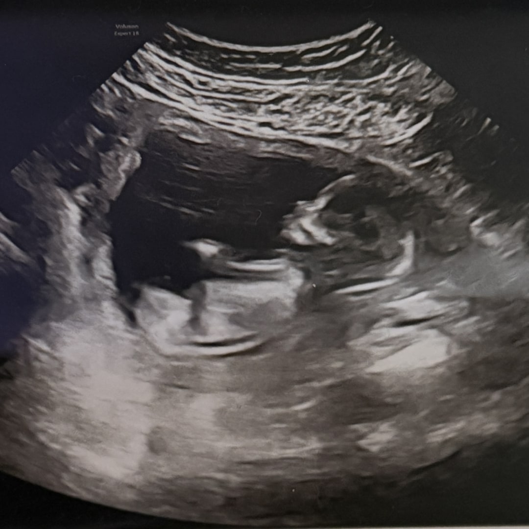 Photo shared by Jay for their Babylist baby registry.