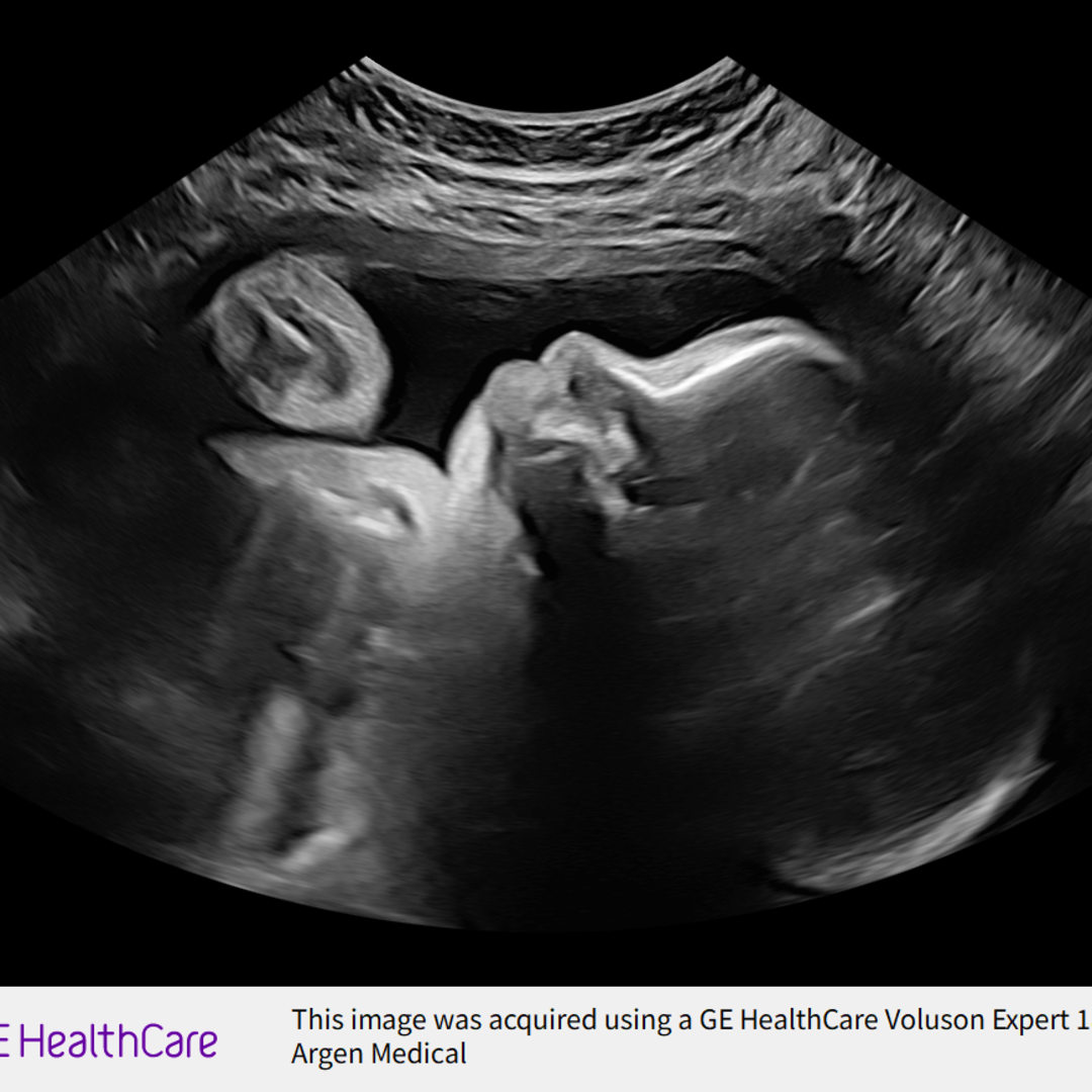 Photo shared by Camille for their Babylist baby registry.