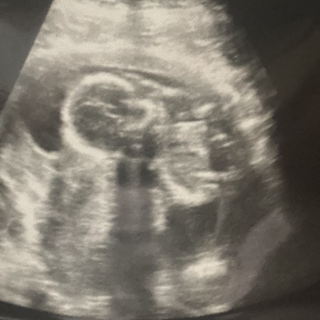 Photo shared by Airele for their Babylist baby registry.