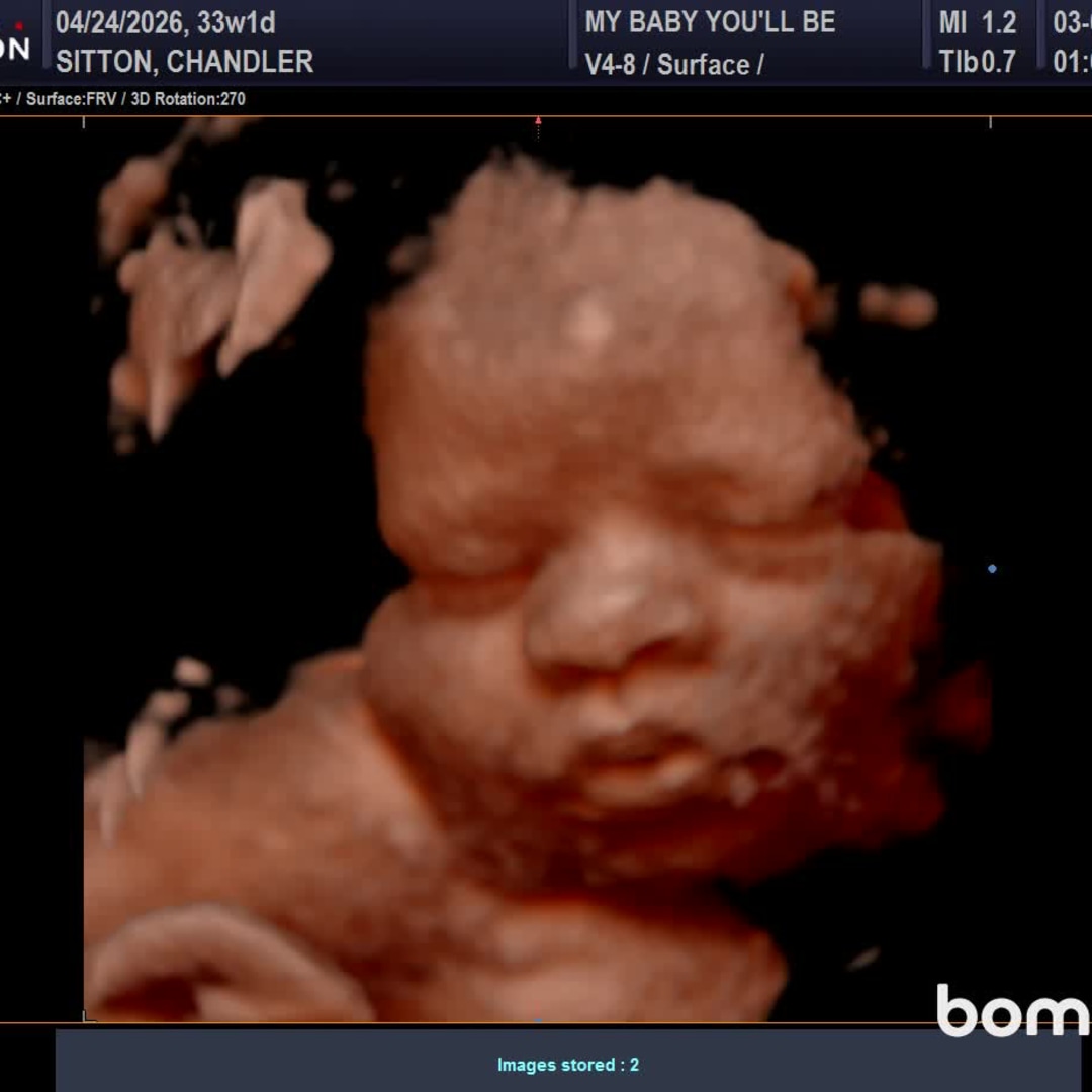 Photo shared by Chandler for their Babylist baby registry.