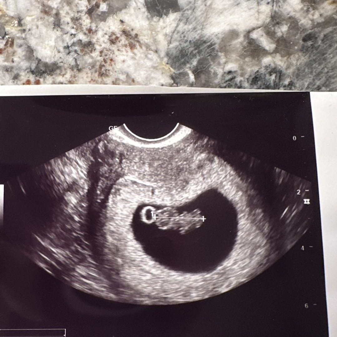 Photo shared by Emily for their Babylist baby registry.