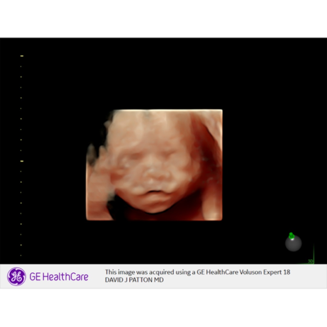 Photo shared by Annie & Carter for their Babylist baby registry.