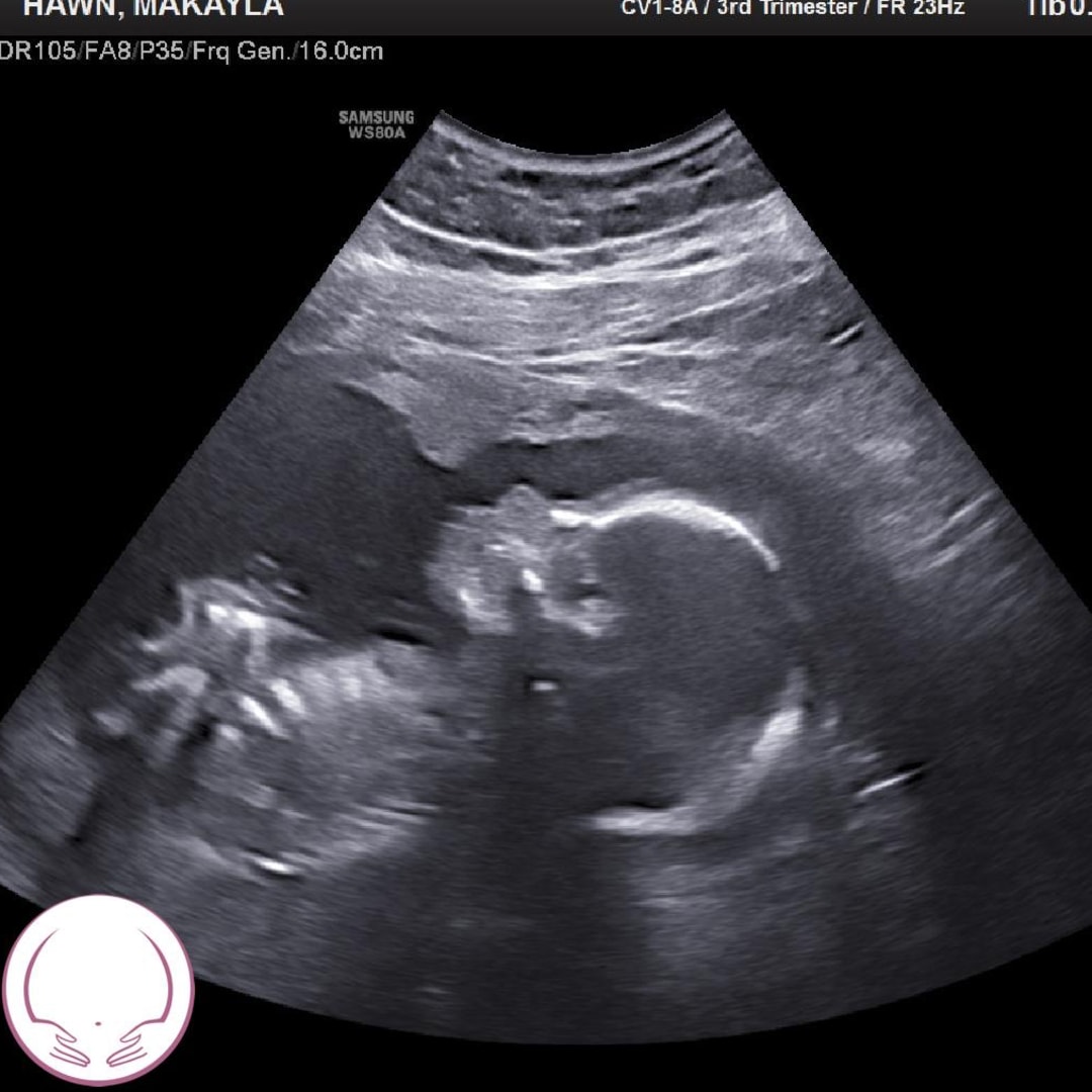 Photo shared by Makayla for their Babylist baby registry.