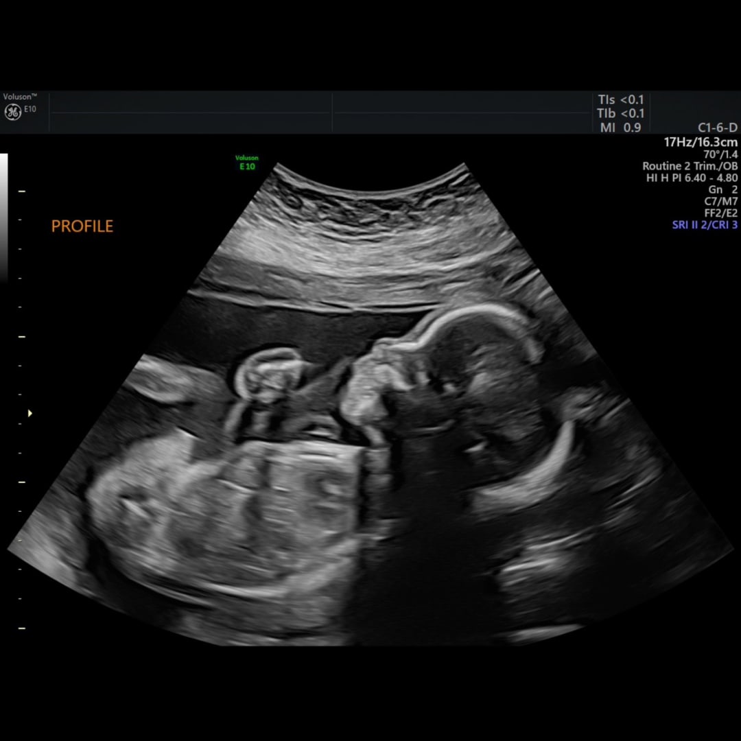 Photo shared by Tia for their Babylist baby registry.