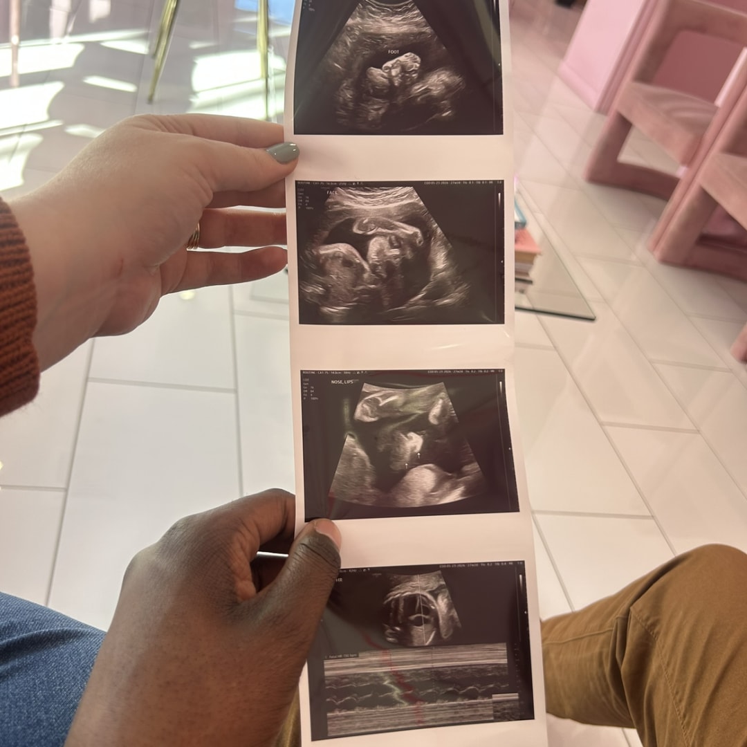 Photo shared by Donna for their Babylist baby registry.