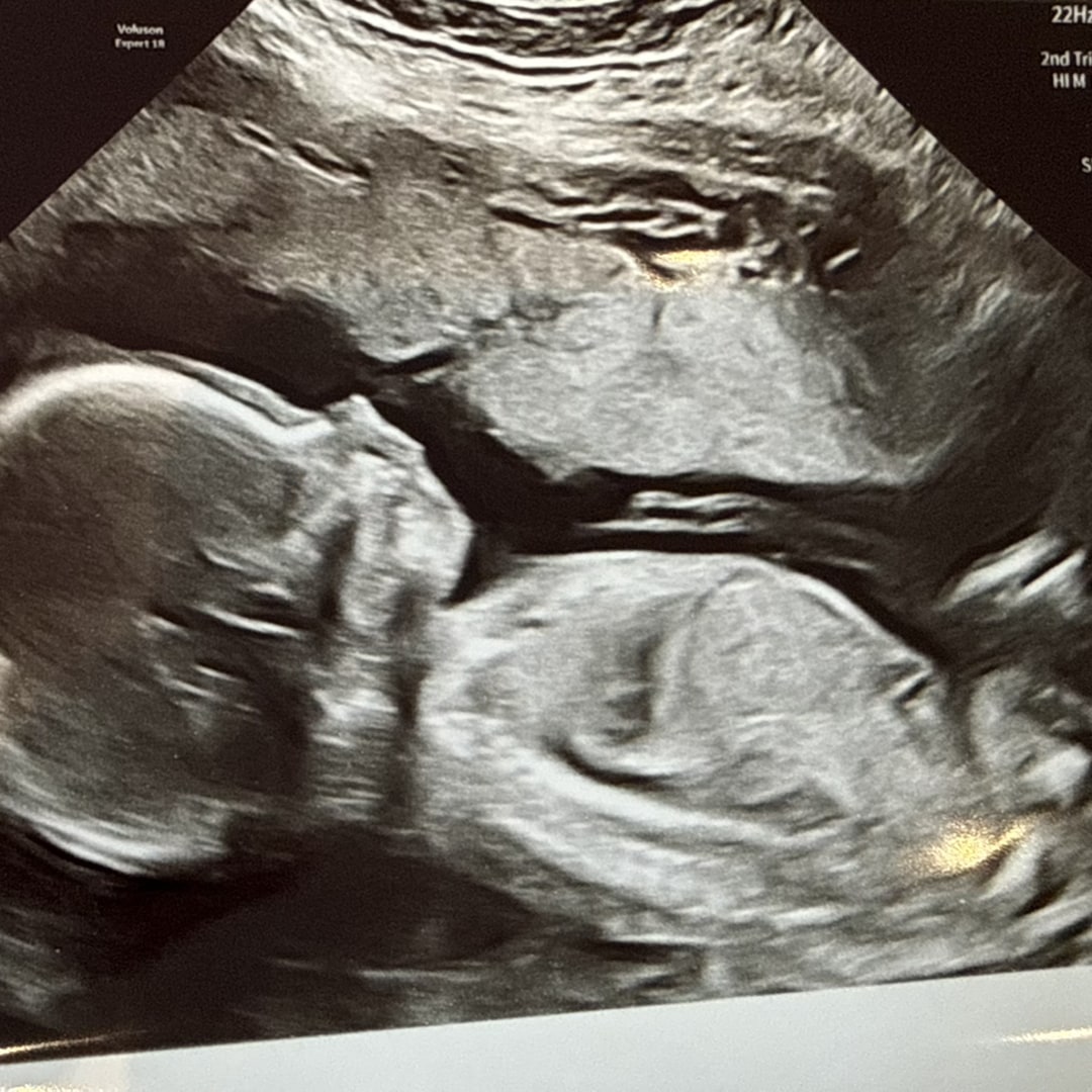 Photo shared by Shaila for their Babylist baby registry.