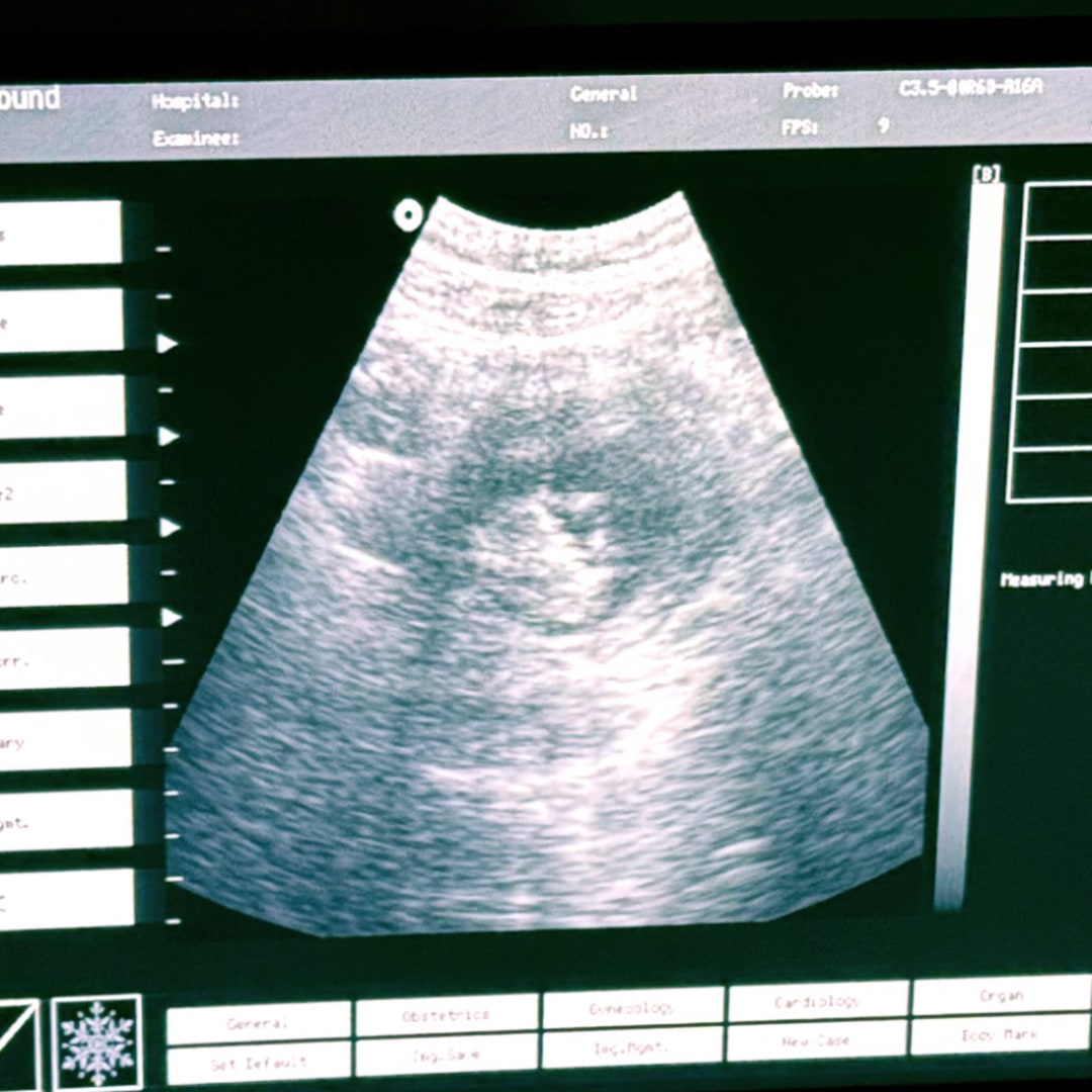 Photo shared by Cassidy for their Babylist baby registry.