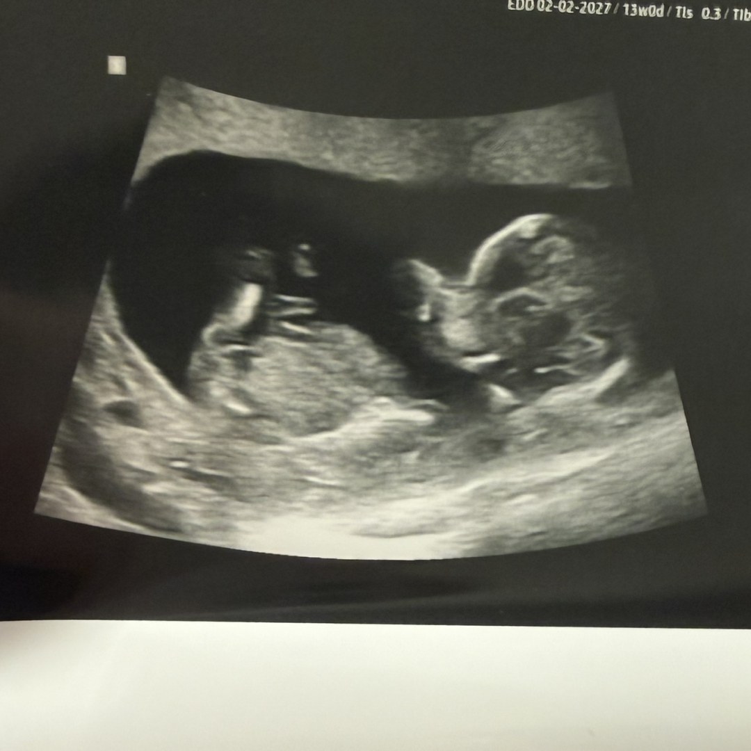 Photo shared by Meghan for their Babylist baby registry.