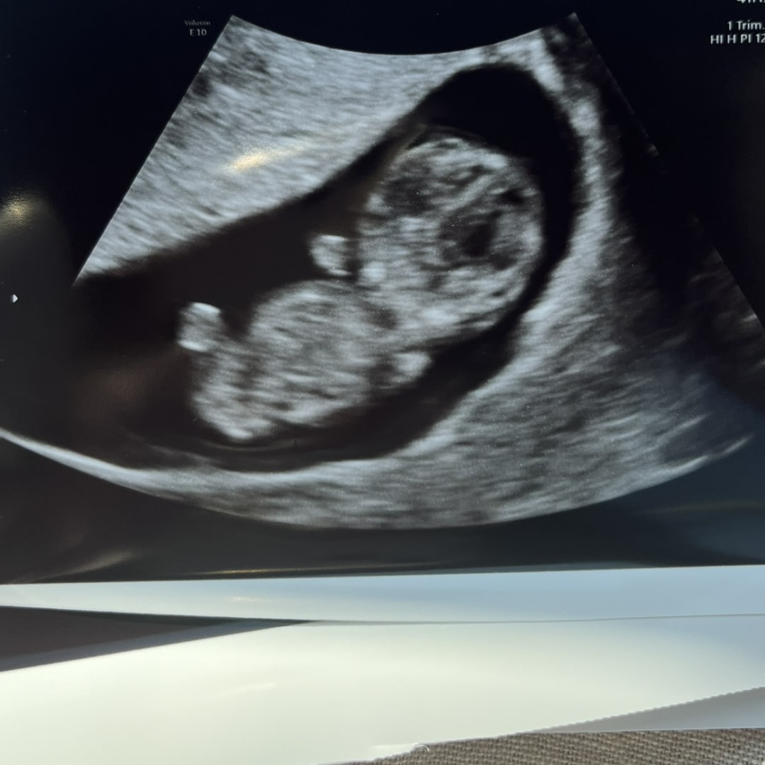 Photo shared by Katie for their Babylist baby registry.