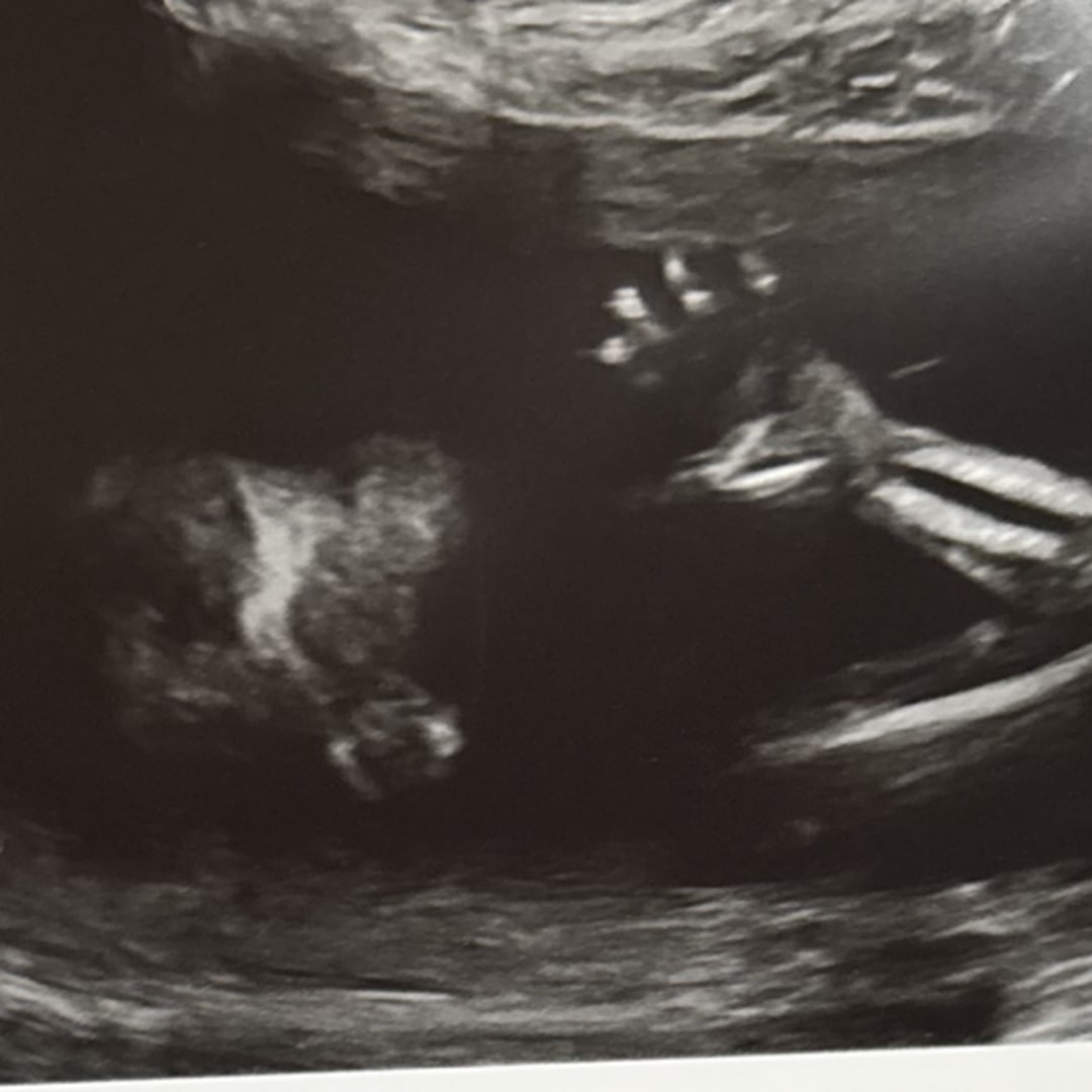 Photo shared by Kimber for their Babylist baby registry.
