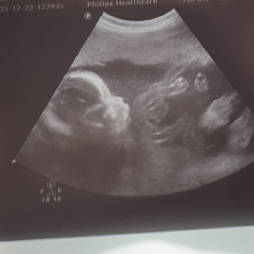 Photo shared by Alondra for their Babylist baby registry.